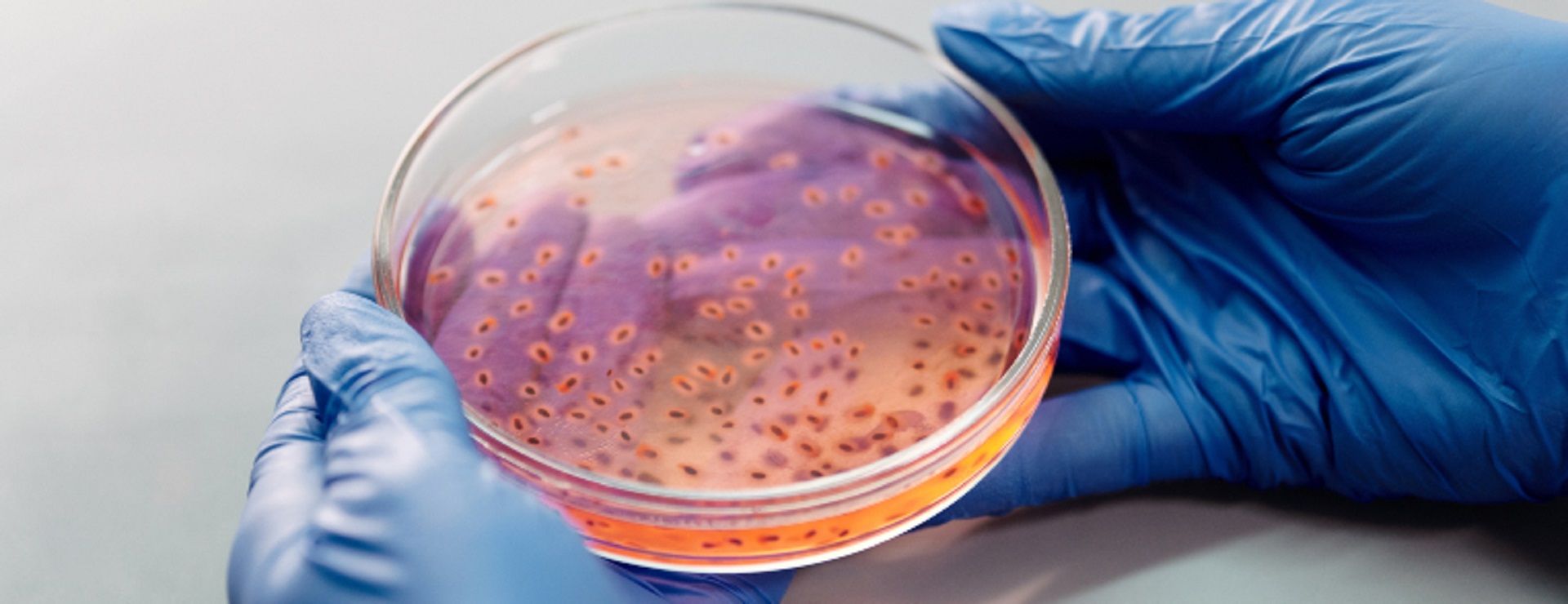 Você já ouviu falar do Candida auris?