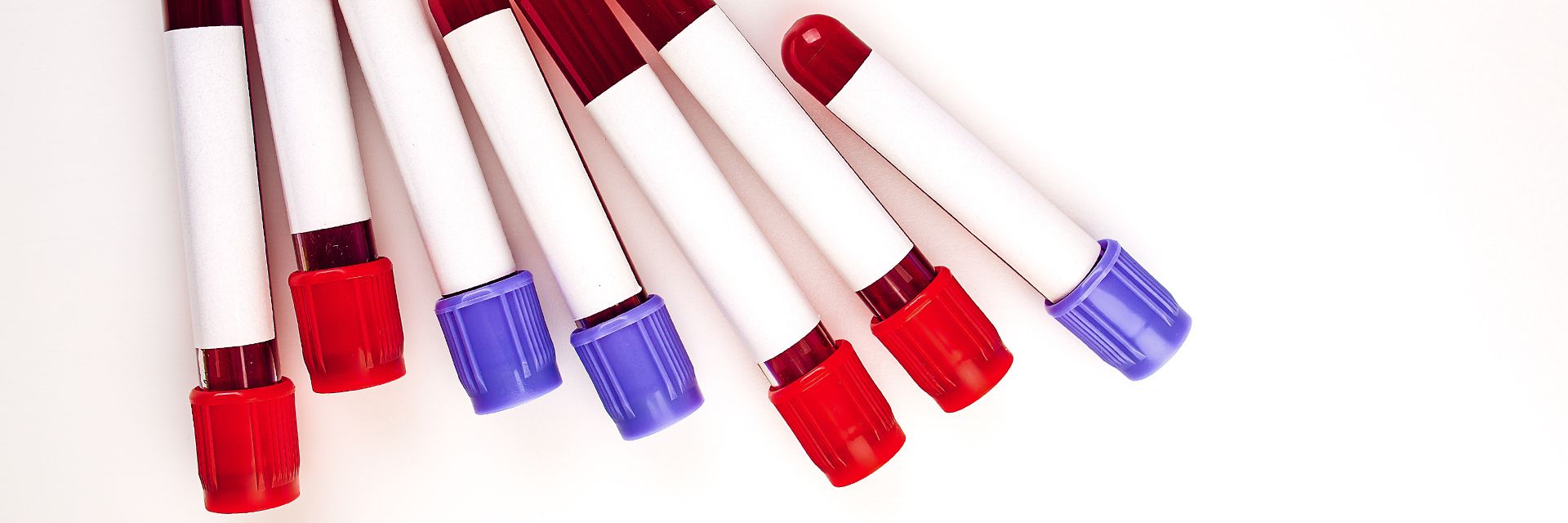 ANS inclui em seu rol exames para detectar o Zika