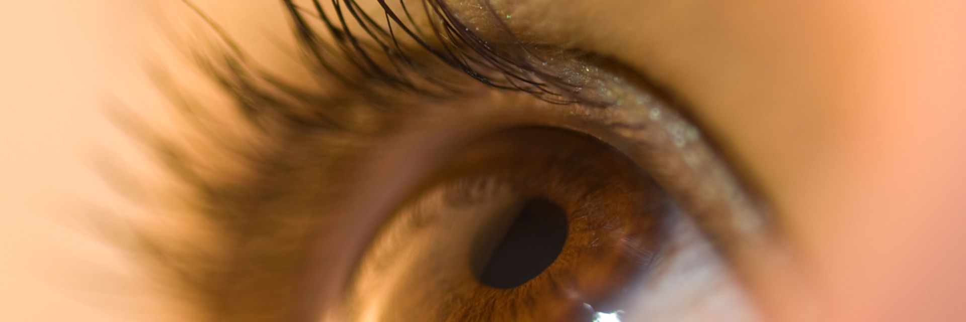 Época de conjuntivite