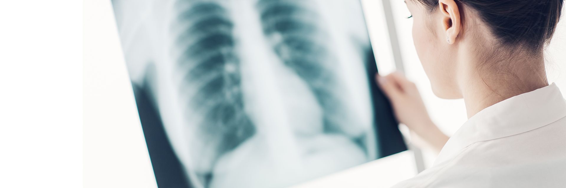 O perigo da tuberculose